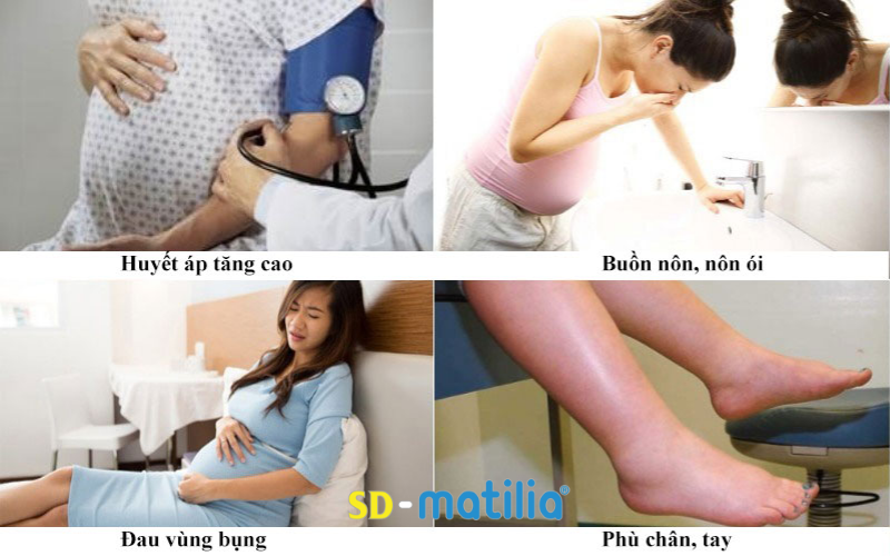 Thừa cân khi mang thai dễ khiến mẹ bị tiểu đường thai kỳ nặng hơn là tiền sản giật rất nguy hiểm